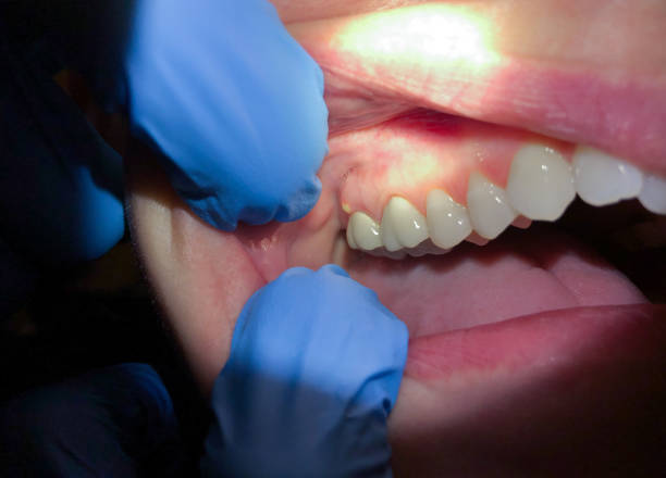  Mountain Road, VA Emergency Dentist Pros